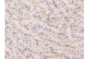 Detection of FABP4 in Mouse Kidney Tissue using Polyclonal Antibody to Fatty Acid Binding Protein 4 (FABP4)