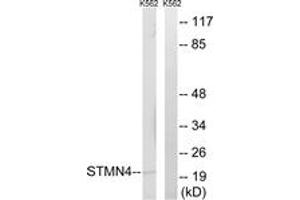 Western blot analysis of extracts from K562 cells, using STMN4 Antibody. (STMN4 antibody  (AA 140-189))