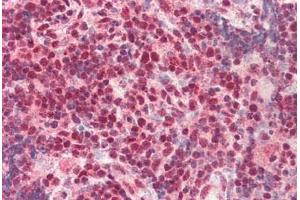 Human, Thymus: Formalin-Fixed Paraffin-Embedded (FFPE) (CTBP1 antibody  (C-Term))
