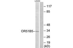 Western blot analysis of extracts from LOVO cells, using OR51B5 Antibody. (OR51B5 antibody  (AA 200-249))