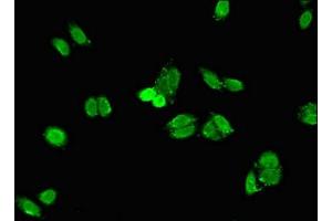 Immunofluorescent analysis of HepG2 cells using ABIN7169453 at dilution of 1:100 and Alexa Fluor 488-congugated AffiniPure Goat Anti-Rabbit IgG(H+L) (SH2D1B antibody  (AA 1-77))