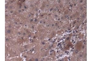 DAB staining on IHC-P; Samples: Human Liver Tissue (P4HA3 antibody  (AA 227-544))