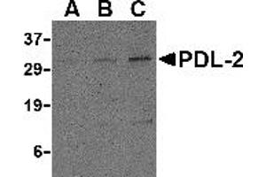 Western Blotting (WB) image for anti-Programmed Cell Death 1 Ligand 2 (PDCD1LG2) (Middle Region) antibody (ABIN1031035) (PDCD1LG2 antibody  (Middle Region))