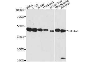 Western blot analysis of extracts of various cell lines, using EIF2S2 antibody. (EIF2S2 antibody)