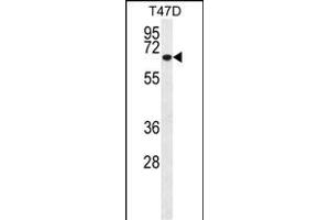 Western blot analysis of P2 Antibody ABIN659015 in T47D cell line lysates (35 μg/lane). (MMP2 antibody)