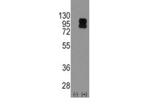 Western blot analysis of CD19 antibody and 293 cell lysate (2 ug/lane) either nontransfected (Lane 1) or transiently transfected with the CD19 gene (2). (CD19 antibody  (AA 143-172))