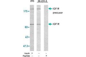Western blot analysis of extracts from 293 and SK-OV-3 cells using IGF1R polyclonal antibody  . (IGF1R antibody)