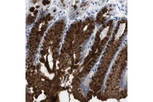 Immunohistochemical staining of human stomach with C1RL polyclonal antibody  shows strong cytoplasmic positivity in glandular cells.
