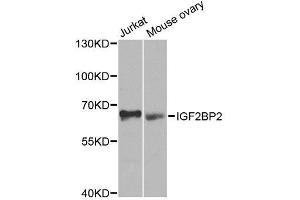 Western blot analysis of extracts of various cell lines, using IGF2BP2 antibody. (IGF2BP2 antibody  (C-Term))