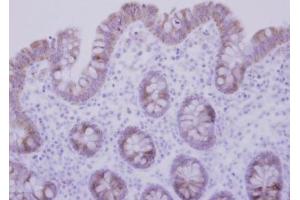 IHC-P Image Immunohistochemical analysis of paraffin-embedded human normal colon, using CCDC83, antibody at 1:500 dilution. (CCDC83 antibody)