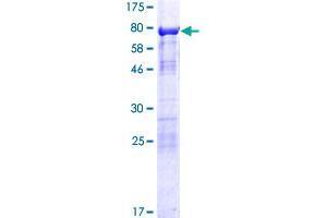 SH3-Binding Domain Protein 5-Like (SH3BP5L) (AA 1-393) protein (GST tag)