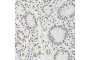 Immunohistochemistry of paraffin-embedded human stomach using HNRNPD Antibody. (HNRNPD/AUF1 antibody  (AA 1-306))