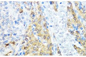 Immunohistochemistry of paraffin-embedded Rat ovary using NOD1 Polyclonal Antibody at dilution of 1:100 (40x lens). (NOD1 antibody)