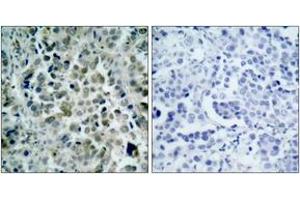 Immunohistochemistry (IHC) image for anti-Histone Deacetylase 8 (HDAC8) (AA 5-54) antibody (ABIN2888999) (HDAC8 antibody  (AA 5-54))