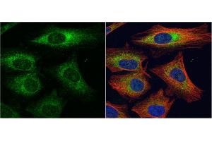 ICC/IF Image alpha Dystroglycan antibody detects alpha Dystroglycan protein at cytoplasm by immunofluorescent analysis. (Dystroglycan antibody)