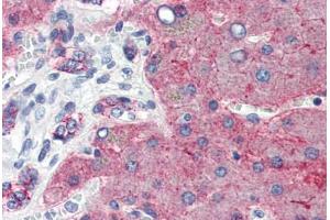 Human Liver (formalin-fixed, paraffin-embedded) stained with CLDN1 antibody ABIN457476 at 5 ug/ml followed by biotinylated goat anti-rabbit IgG secondary antibody ABIN481713, alkaline phosphatase-streptavidin and chromogen. (Claudin 1 antibody  (C-Term))