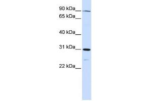 WB Suggested Anti-LONRF3 Antibody Titration:  0. (LONRF3 antibody  (N-Term))