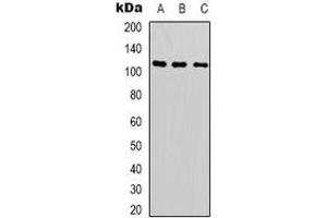 Western blot analysis of SUPT16H expression in Hela (A), A549 (B), Jurkat (C) whole cell lysates. (SUPT16H antibody  (C-Term))