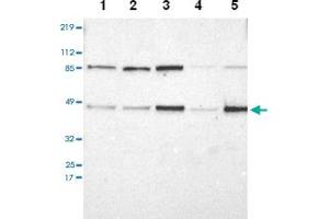 Western blot analysis of Lane 1: RT-4, Lane 2: U-251 MG, Lane 3: A-431, Lane 4: Liver, Lane 5: Tonsil with IRF9 polyclonal antibody at 1:250-1:500 dilution.