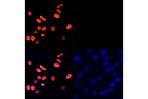 Immunofluorescence analysis of C6 cells treated by TSA (upper left) and untreated C6 cells (upper right) using Acetyl-Histone H3-K27 Rabbit pAb (red, ABIN7267670) at dilution of 1:100. (Histone 3 antibody  (H3K27))