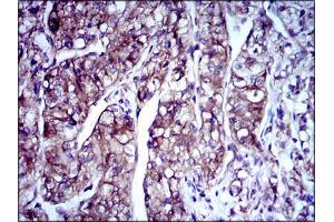 Immunohistochemistry (IHC) image for anti-Doublecortin (DCX) (AA 362-411) antibody (ABIN969513)