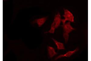 ABIN6267261 staining SK-OV3 by IF/ICC. (EGFR antibody  (pSer1070))