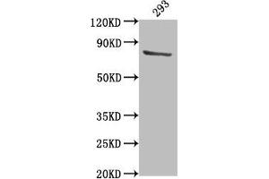 Western Blot Positive WB detected in: 293 whole cell lysate All lanes: TBK1 antibody at 1:2000 Secondary Goat polyclonal to rabbit IgG at 1/50000 dilution Predicted band size: 84 kDa Observed band size: 84 kDa (TBK1 antibody  (AA 644-661))