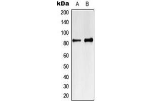 Western blot analysis of MARK4 expression in Jurkat (A), K562 (B) whole cell lysates. (MARK4 antibody  (Center))