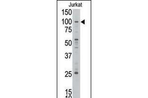 Western blot analysis of anti-MLLT10 Pab in Jurkat cell line lysate. (MLLT10 antibody  (C-Term))
