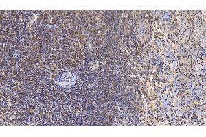 Detection of VF in Human Spleen Tissue using Monoclonal Antibody to Visfatin (VF) (NAMPT antibody  (AA 1-491))