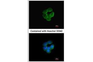 ICC/IF Image Immunofluorescence analysis of methanol-fixed A431, using NNT, antibody at 1:200 dilution.