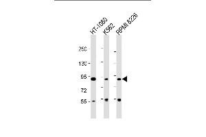 All lanes : Anti-DEF Antibody (N-term) at 1:2000 dilution Lane 1: HT-1080 whole cell lysate Lane 2: K562 whole cell lysate Lane 3: RI 8226 whole cell lysate Lysates/proteins at 20 μg per lane. (ZC3H18 antibody  (N-Term))