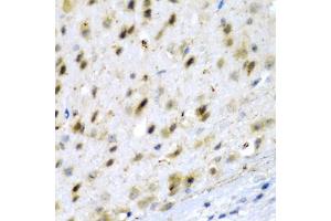Immunohistochemistry of paraffin-embedded mouse brain using TPH2 antibody (ABIN5974298) at dilution of 1/200 (40x lens). (Tryptophan Hydroxylase 2 antibody)