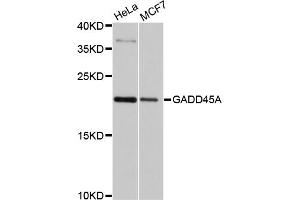 Western blot analysis of extracts of various cell lines, using GADD45A antibody (ABIN4903730) at 1:1000 dilution.