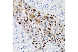 Immunohistochemistry (IHC) image for anti-Cyclin D1 (CCND1) antibody (ABIN7266561)
