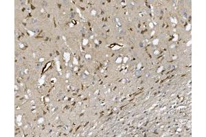 IHC analysis of CD34 using anti-CD34 antibody (ABIN7600282). (CD34 antibody  (AA 170-386))