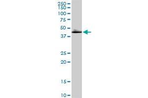 DLST MaxPab rabbit polyclonal antibody. (DLST antibody  (AA 1-453))