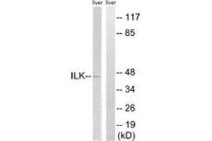 Western blot analysis of extracts from rat liver cells, using ILK (Ab-246) Antibody.