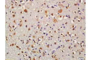 Formalin-fixed and paraffin embedded mouse brain labeled with Anti-Bid Polyclonal Antibody, Unconjugated  at 1:200 followed by conjugation to the secondary antibody and DAB staining