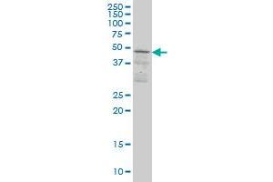 SCAP1 monoclonal antibody (M02), clone 1C11 Western Blot analysis of SCAP1 expression in Jurkat . (SKAP1 antibody  (AA 1-100))