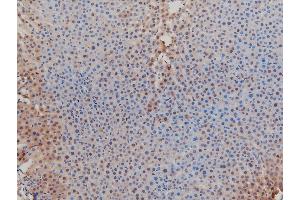 ABIN6267554 at 1/100 staining rat liver tissue sections by IHC-P.