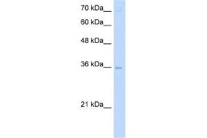 WB Suggested Anti-PRIM2 Antibody Titration:  5.