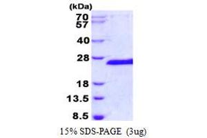 Image no. 1 for E3 Ubiquitin-Protein Ligase SIAH1 (SIAH1) protein (His tag) (ABIN1098362)