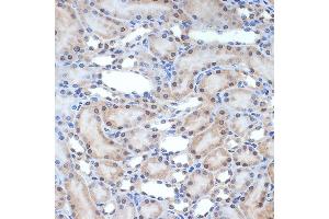 Immunohistochemistry of paraffin-embedded rat kidney using XPD/ERCC2 Rabbit mAb (ABIN7267057) at dilution of 1:100 (40x lens). (ERCC2 antibody)