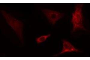 ABIN6275702 staining  COLO205 cells by IF/ICC. (SLC39A4 antibody  (Internal Region))