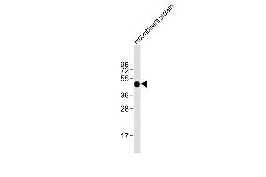 Human recombinant protein at 20 µg per lane, probed with bsm-51354M FAT1 (1634CT464.