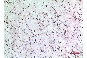 Immunohistochemistry (IHC) analysis of paraffin-embedded Human Brain, antibody was diluted at 1:100. (P57 (Ser24) antibody)