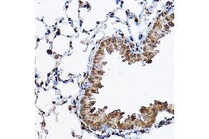 Immunohistochemistry (IHC) image for anti-Ribosomal Protein S6 Kinase, 70kDa, Polypeptide 1 (RPS6KB1) (AA 361-525) antibody (ABIN7270029)