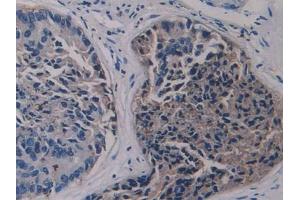 Used in DAB staining on fromalin fixed paraffin- embedded kidney tissue (LSR antibody  (AA 335-589))