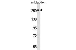 MYH9 Antibody (N-term ) (ABIN6243267 and ABIN6577348) western blot analysis in mouse bladder tissue lysates (35 μg/lane).